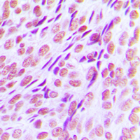 19 - Anti-RUNX1 Antibody AP59980
