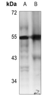 1 - Anti-RUNX1 Antibody AP59980