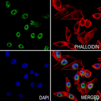 3 - Anti-Cyclin E1 (Phospho-T395) Antibody AP59981