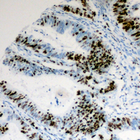19 - Anti-Cyclin E1 (Phospho-T395) Antibody AP59981