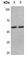 1 - Anti-Cyclin E1 (Phospho-T395) Antibody AP59981