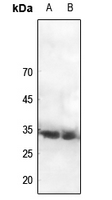1 - Anti-CDC2 (Phospho-Y15) Antibody AP59982