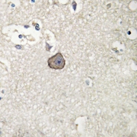 19 - Anti-M Cadherin Antibody AP59984