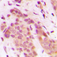 19 - Anti-CDK8 Antibody AP59986