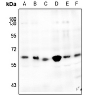 1 - Anti-CDK8 Antibody AP59986
