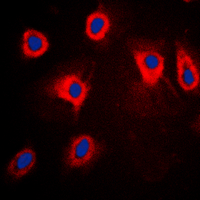 3 - Anti-TPL2 (Phospho-T290) Antibody AP59989