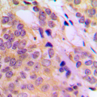 19 - Anti-TPL2 (Phospho-T290) Antibody AP59989