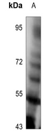 1 - Anti-TPL2 (Phospho-T290) Antibody AP59989