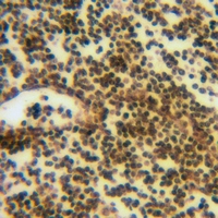 19 - Anti-ATF6B Antibody AP59990