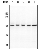 1 - Anti-ATF6B Antibody AP59990