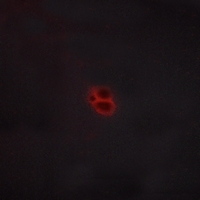 3 - Anti-CRHR1 Antibody AP59991
