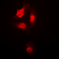 3 - Anti-p38 (Phospho-T180) Antibody AP59993