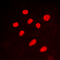 3 - Anti-CTBP2 Antibody [KO/KD Validated] AP59996