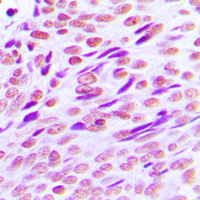 19 - Anti-CTBP2 Antibody [KO/KD Validated] AP59996