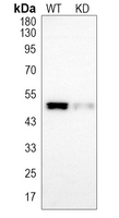 0 - Anti-CTBP2 Antibody [KO/KD Validated] AP59996