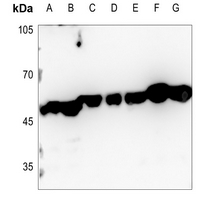 1 - Anti-CTBP2 Antibody [KO/KD Validated] AP59996