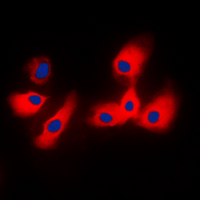 3 - Anti-Cytochrome P450 2A6 Antibody AP59997