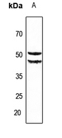 1 - Anti-Cytochrome P450 2A6 Antibody AP59997