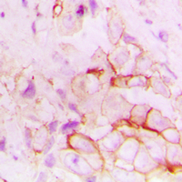 19 - Anti-CD143 Antibody AP59998