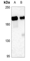 1 - Anti-CD143 Antibody AP59998