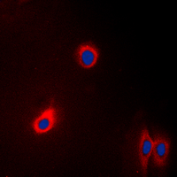 3 - Anti-EEF2 Antibody [KO/KD Validated] AP60000