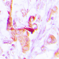 19 - Anti-EEF2 Antibody [KO/KD Validated] AP60000