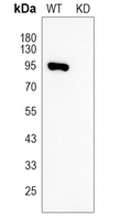0 - Anti-EEF2 Antibody [KO/KD Validated] AP60000