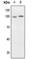 1 - Anti-EEF2 Antibody [KO/KD Validated] AP60000
