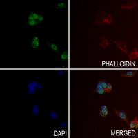3 - Anti-Estrogen Receptor alpha (Phospho-S118) Antibody AP60003
