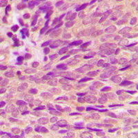 19 - Anti-Estrogen Receptor alpha (Phospho-S118) Antibody AP60003