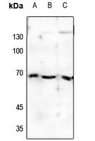 1 - Anti-Estrogen Receptor alpha (Phospho-S118) Antibody AP60003