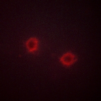 3 - Anti-FGFR1 Antibody AP60004