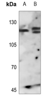 1 - Anti-FGFR1 Antibody AP60004