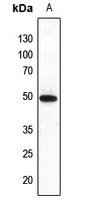 1 - Anti-FNTB Antibody AP60005