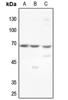 1 - Anti-GCKR Antibody AP60006