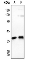 1 - Anti-Connexin 37 Antibody AP60007