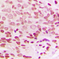 19 - Anti-Histone H1.0 Antibody AP60009
