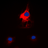 3 - Anti-HARS Antibody AP60010