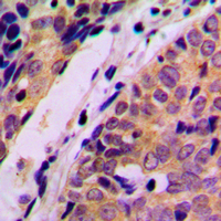 19 - Anti-HARS Antibody AP60010