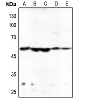 1 - Anti-HARS Antibody AP60010