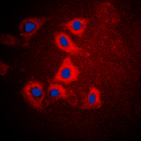 3 - Anti-HEXB Antibody AP60011