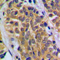 19 - Anti-HEXB Antibody AP60011