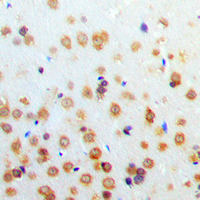 19 - Anti-HIF1 alpha Antibody AP60012