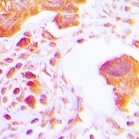 19 - Anti-Hexokinase 3 Antibody AP60013