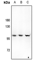 1 - Anti-Hexokinase 3 Antibody AP60013
