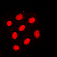 3 - Anti-HNF4 alpha (Phospho-S313) Antibody AP60014