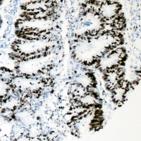 19 - Anti-HNF4 alpha (Phospho-S313) Antibody AP60014