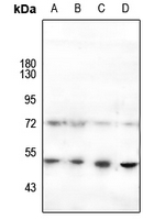 1 - Anti-HNF4 alpha (Phospho-S313) Antibody AP60014