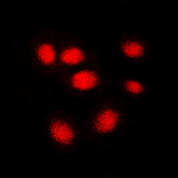 3 - Anti-hNRNP C Antibody AP60015