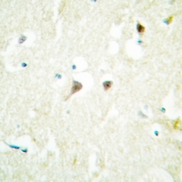 19 - Anti-hNRNP C Antibody AP60015